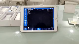 مسبار الموجات فوق الصوتية اللاسلكي ثنائي الرأس لتشخيص OB GYN