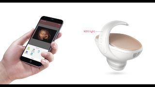 كاميرا Marvoto Fetus M1 - الموجات فوق الصوتية المحمولة ثلاثية الأبعاد