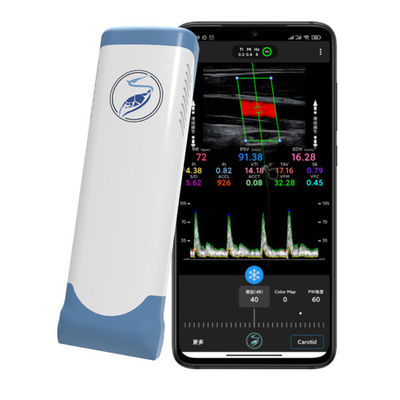 شراء ماسح ضوئي بالموجات فوق الصوتية لاسلكي محمول بتردد 12 ميجا هرتز لأجهزة iPhone وiPad | مسبار دوبلر ملون للمصفوفة الخطية الإلكترونية online manufacture