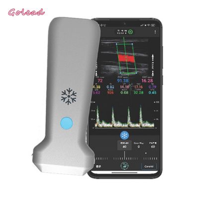 شراء ماسح بالموجات فوق الصوتية بمسبار محدب 126 مم لعصب MSK الوعائي online manufacture