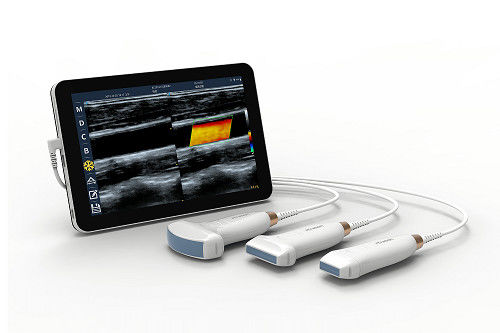 شراء ماسح ضوئي بالموجات فوق الصوتية الخطي المحمول USB من النوع C بسرعة 10 ميجاهرتز ومسبار الموجات فوق الصوتية المحمول بنظام Android للأوعية الدموية والبوكوس online manufacture