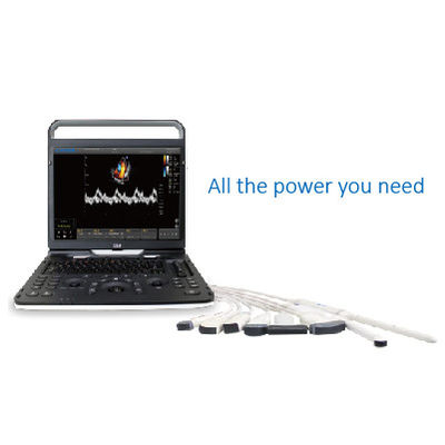 شراء 128 Element Wifi Ultrasound Chison EBit 60 للقلب والأوعية الدموية online manufacture
