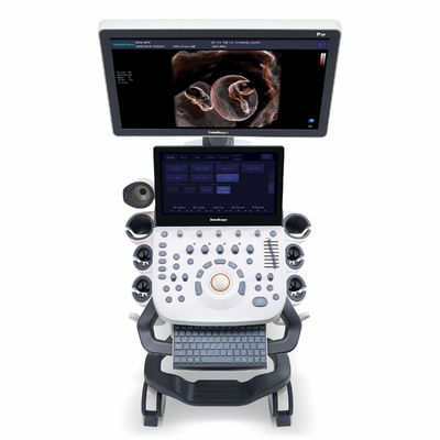 شراء 4D Elastography SonoScape آلة الموجات فوق الصوتية لأمراض النساء والتوليد online manufacture