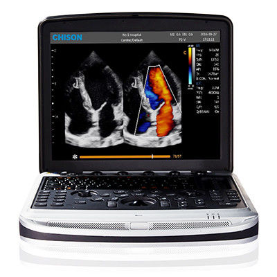 شراء سهلة الحمل 4D Chison SonoBook 9 جهاز كمبيوتر محمول بالموجات فوق الصوتية online manufacture