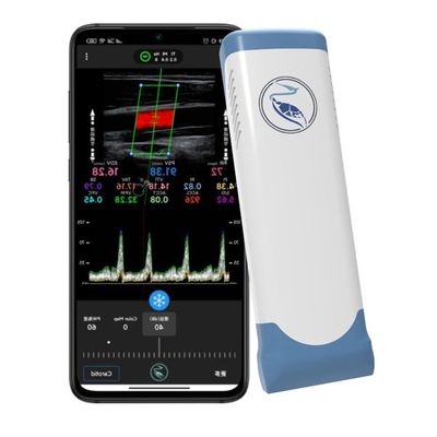 شراء صدى اللون دوبلر لاسلكي محمول بالموجات فوق الصوتية الماسح الضوئي 100 إطار online manufacture