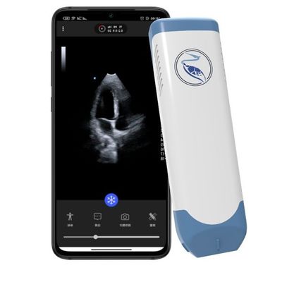 شراء ماسح بالموجات فوق الصوتية محمول بعمق 18.9 سم لهاتف Iphone 3.6 ميجا هرتز online manufacture