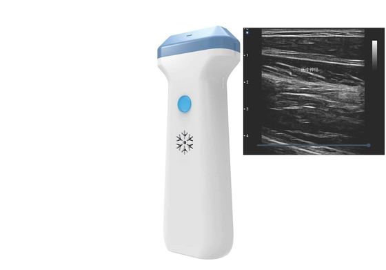 شراء DICOM BMP PNG JPEG 128 Element Wifi Ultrasound Probe 80 To180dB online manufacture