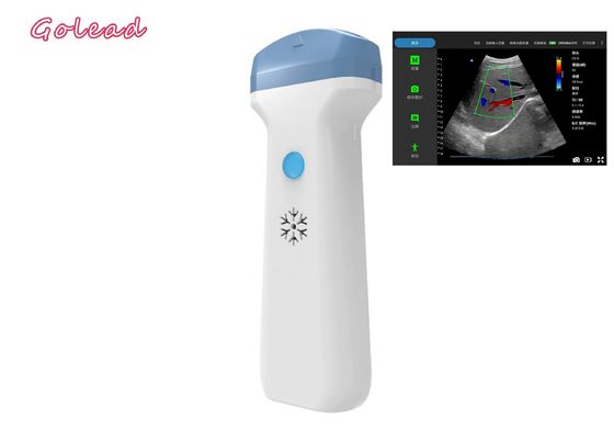 شراء مسبار الموجات فوق الصوتية اللاسلكي Ipad التخدير لامتحانات POCUS الرعاية الأولية online manufacture