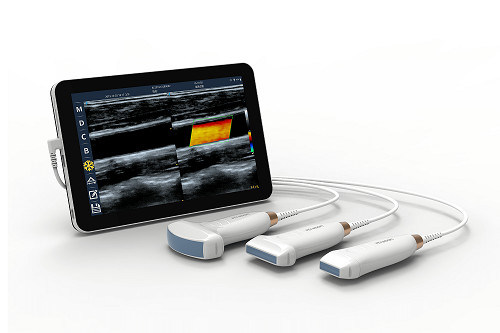 ماسح ضوئي بالموجات فوق الصوتية الخطي المحمول USB من النوع C بسرعة 10 ميجاهرتز ومسبار الموجات فوق الصوتية المحمول بنظام Android للأوعية الدموية والبوكوس