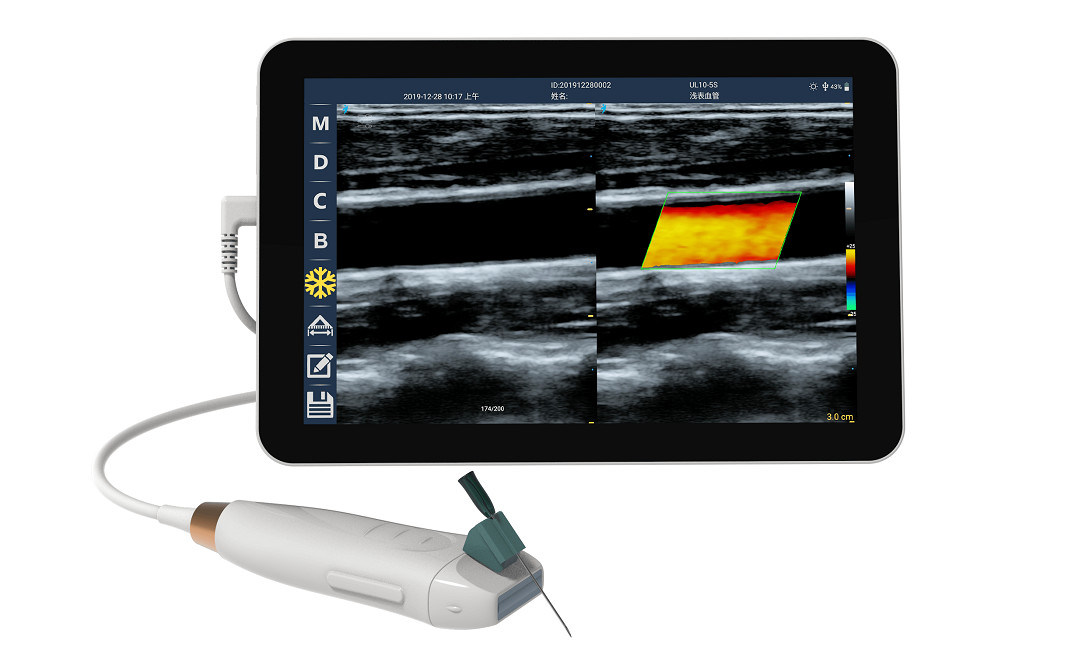 ماسح بالموجات فوق الصوتية المحمولة مع 12MHZ دراسة خطية عالية التردد للوصول الوعائي الدقيق وإجراءات إدخال PICC